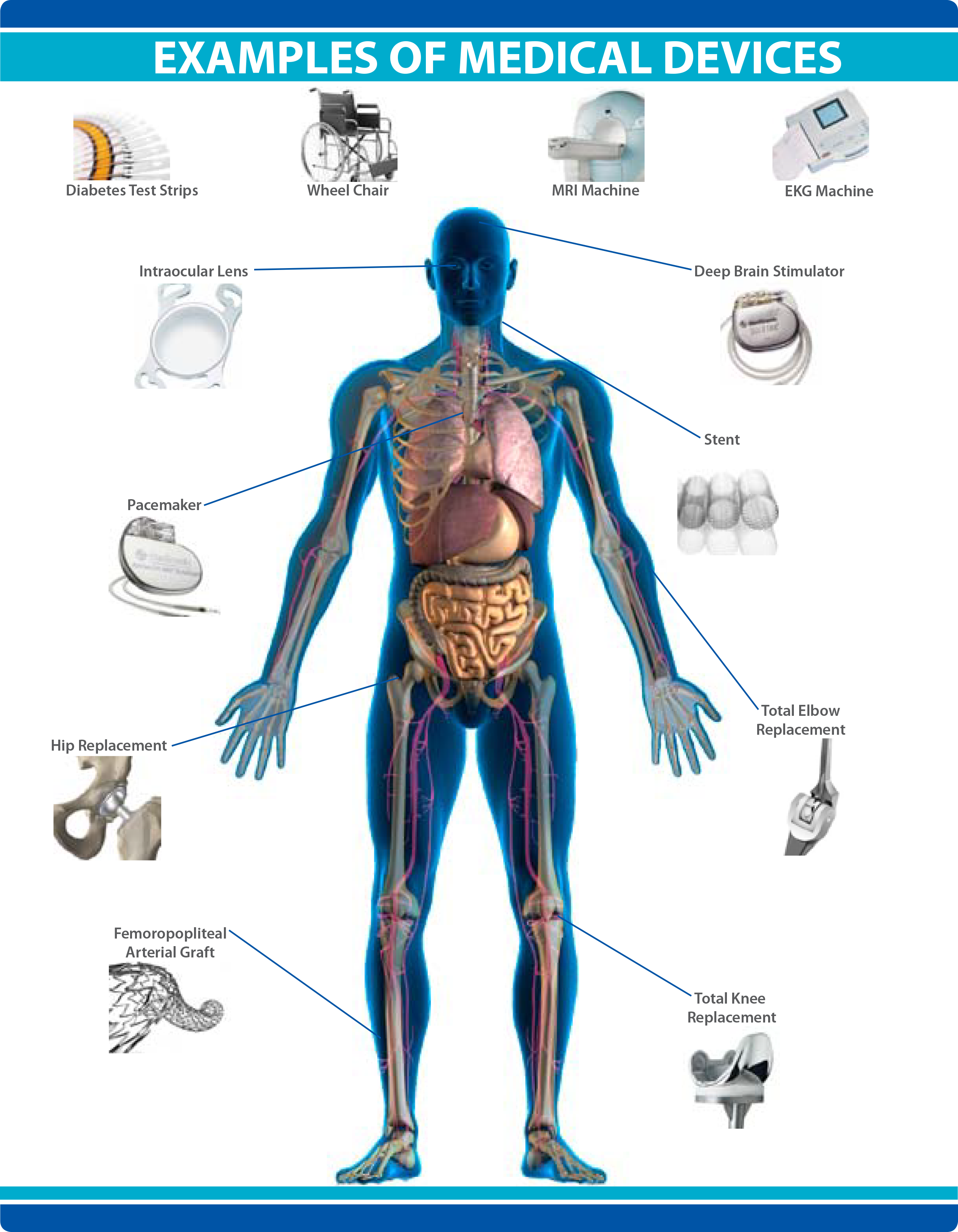 Examples of Medical Devices